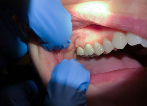 Best Broken Tooth Emergency  in San Diego, TX